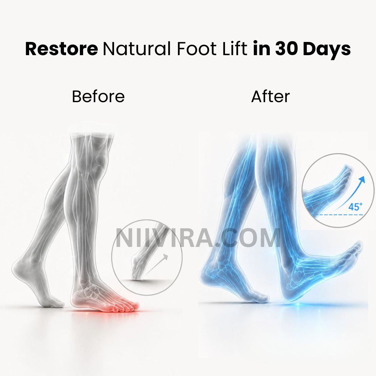 NeuroStep for MS - Lift Your Foot Again (A Pair)