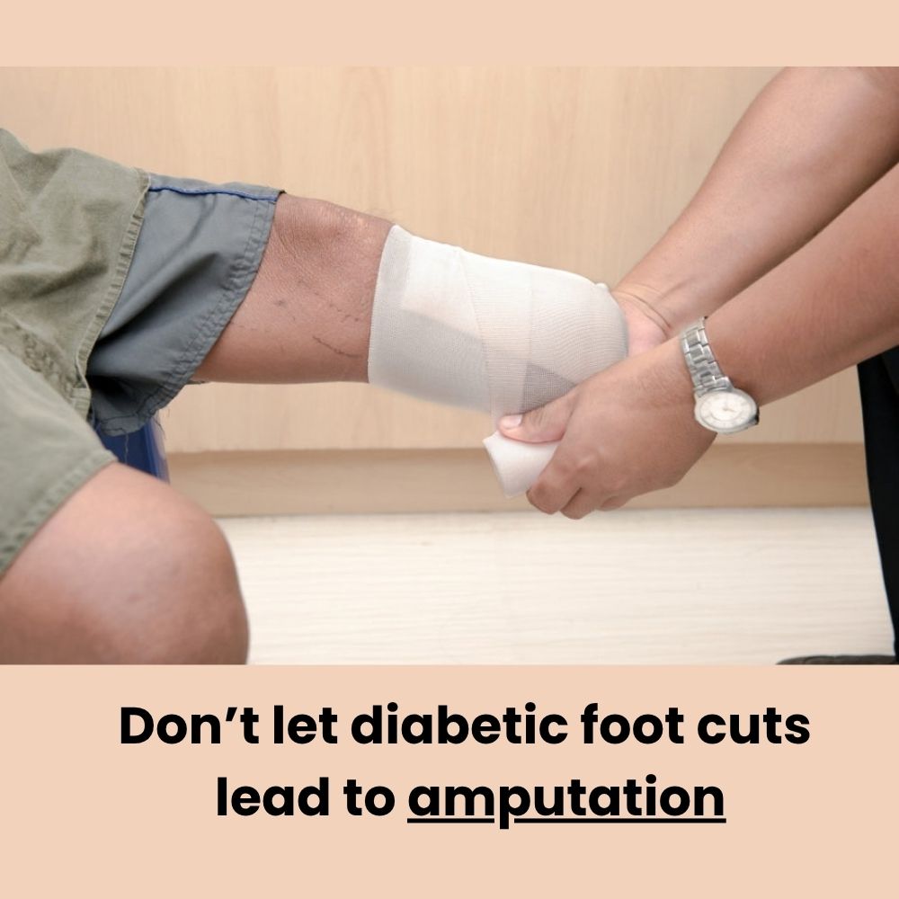 NeuropathyStep - Protect your feet before a small sore gets worse (a pair)