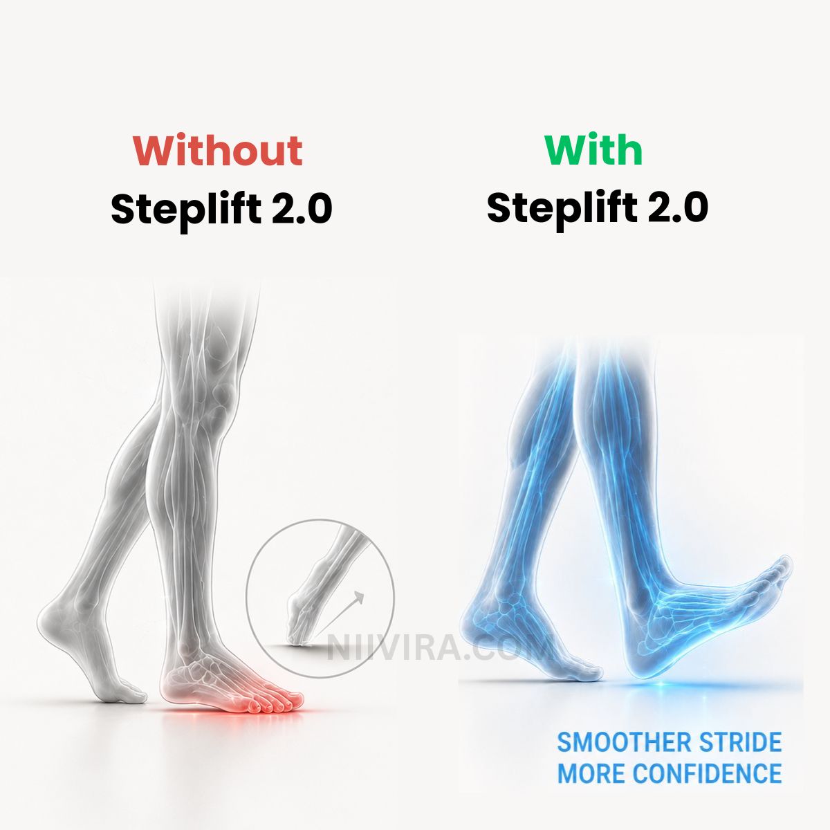 StepLift 2.0 - Instantly stops drop foot (Adjustable)
