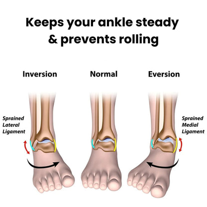 StepLift 2.0 - Instantly stops drop foot (Adjustable)